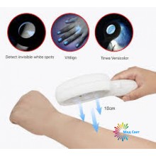 Лампа Вуда BZ-300 професійна з 2,5× збільшенням Лампа Вуда BZ-300 професійна з 2,5× збільшенням