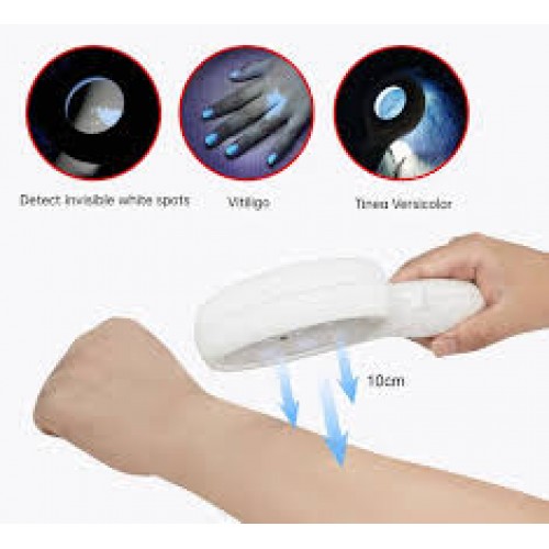 Лампа Вуда BZ-300 професійна з 2,5× збільшенням 